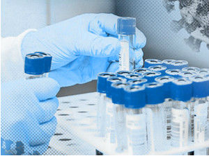 Planira se uvođenje testova na antitela, koštaće do 1.200 dinara
