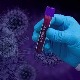 Ruski centar: Mutacije korone ne utiču na efikasnost razvijene vakcine